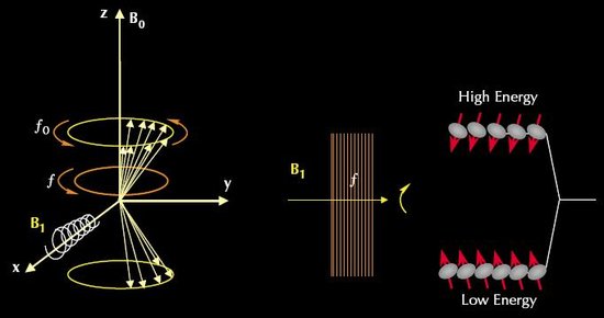 什么是核磁共振?核磁共振的基本原理!-生物学